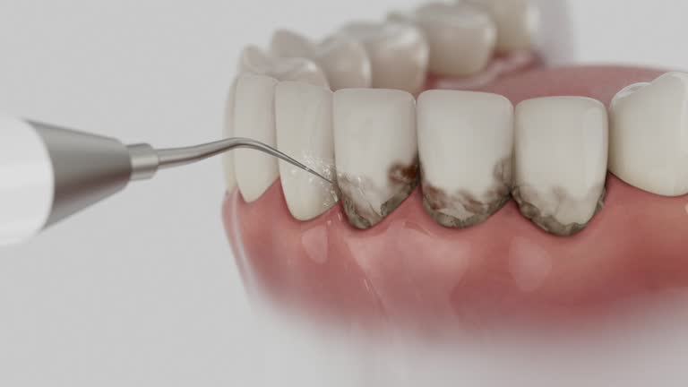 Trusted Teeth Cleaning And Checkup service in Winamac, IN - Dentist Open Now